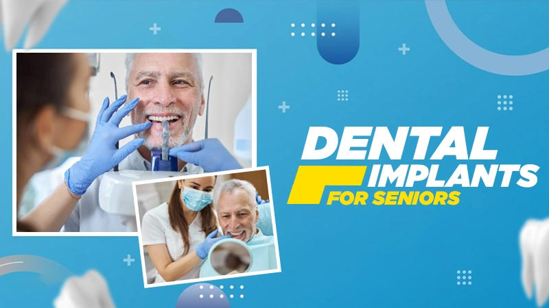 dental implants for seniors